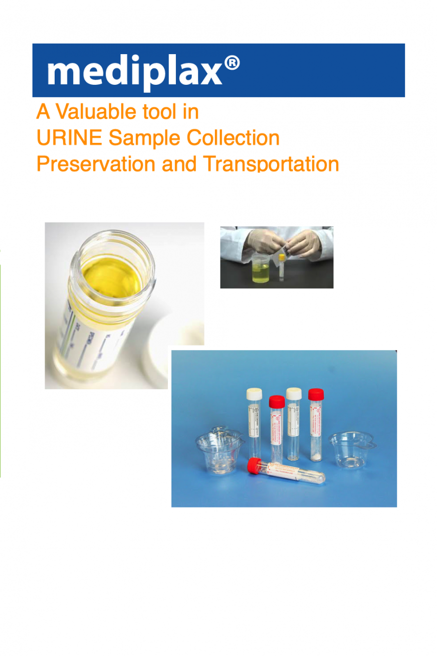 urine.png